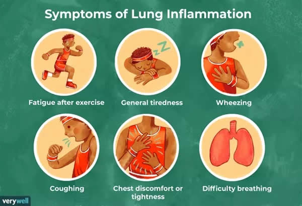 positive-health-online-article-what-is-inflammation-of-the-lungs